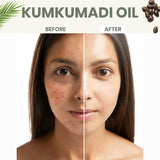 Beauty - Kumkumadi Oil - Anti-Ageing Kumkumadi Night Serum For Pigmentation, 30ml